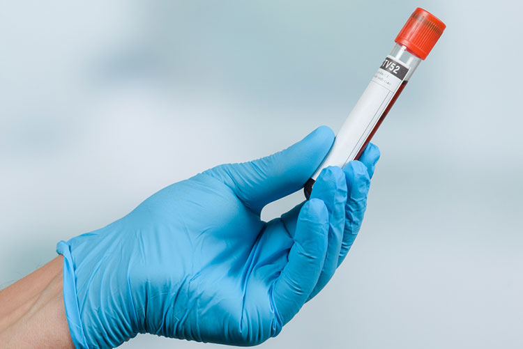 What is the Normal Range for a Double Marker Test?